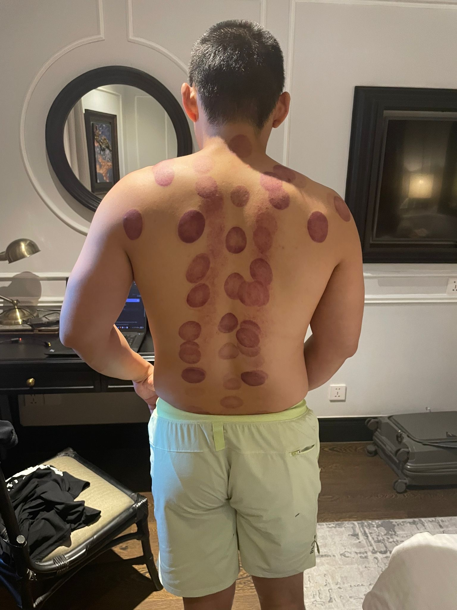 cupping results